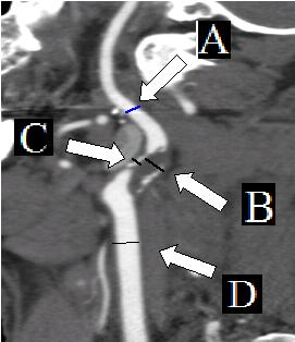 Case of the Month Image